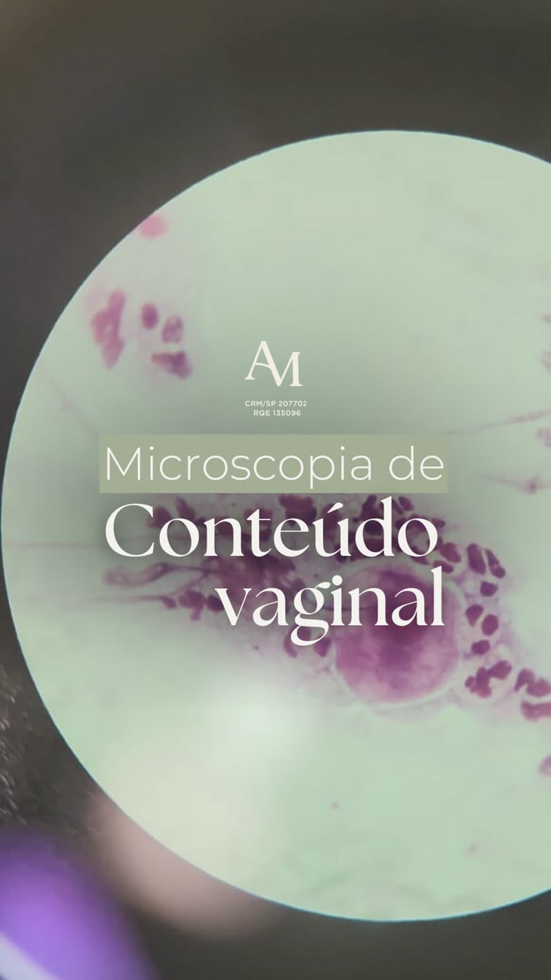 Microscopia Vaginal: Diagnóstico na Hora com Precisão